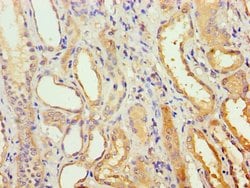 Invitrogen AGPAT1 Polyclonal Antibody 100 &mu;L; Unconjugated:Antibodies,