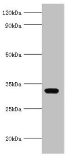 Invitrogen AGPAT1 Polyclonal Antibody 100 &mu;L; Unconjugated:Antibodies,