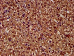 Invitrogen MICU1 Polyclonal Antibody 100 &mu;g; Unconjugated:Antibodies,