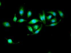 Invitrogen ERAB Polyclonal Antibody 100 &mu;g; Unconjugated:Antibodies,