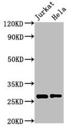 Invitrogen ERAB Polyclonal Antibody 100 &mu;g; Unconjugated:Antibodies,