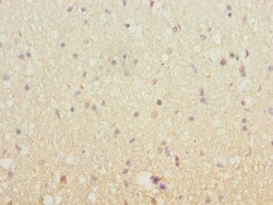 SH3GL2 Polyclonal Antibody:Antibodies, Polyclonal