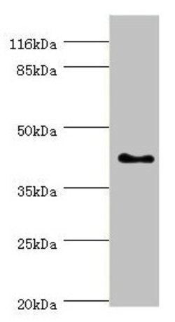 SH3GL2 Polyclonal Antibody:Antibodies, Polyclonal