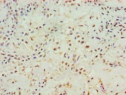 Invitrogen Aminoacylase Polyclonal Antibody 100 &mu;L; Unconjugated:Antibodies,