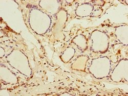 Invitrogen DDX50 Polyclonal Antibody 100 &mu;g; Unconjugated:Antibodies,