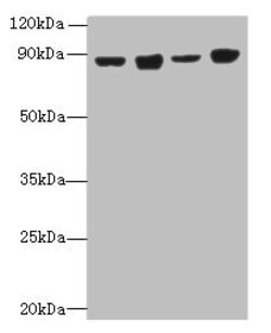 Invitrogen DDX50 Polyclonal Antibody 100 &mu;g; Unconjugated:Antibodies,