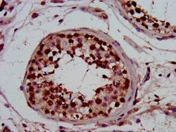 Invitrogen PIN4 Polyclonal Antibody 100 &mu;g; Unconjugated:Antibodies,