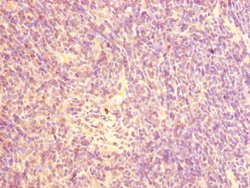 Invitrogen CHRNA10 Polyclonal Antibody 100 &mu;L | Buy Online | Invitrogen&trade; | Fisher Scientific