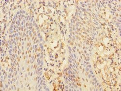 Invitrogen CHRNA10 Polyclonal Antibody 100 &mu;L | Buy Online | Invitrogen&trade; | Fisher Scientific