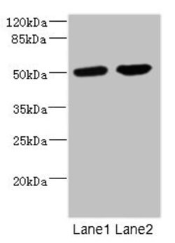 Invitrogen CHRNA10 Polyclonal Antibody 100 &mu;L | Buy Online | Invitrogen&trade; | Fisher Scientific