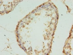 Invitrogen MRPL18 Polyclonal Antibody 100 &mu;g; Unconjugated:Antibodies,