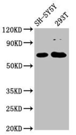 Invitrogen GALNT9 Polyclonal Antibody 100 &mu;g; Unconjugated:Antibodies,