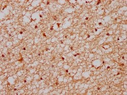 XAB2 Polyclonal Antibody:Antibodies, Polyclonal