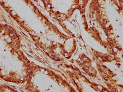 XAB2 Polyclonal Antibody:Antibodies, Polyclonal