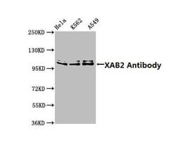 XAB2 Polyclonal Antibody:Antibodies, Polyclonal
