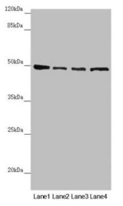 Invitrogen AP1M1 Polyclonal Antibody 100 &mu;L; Unconjugated:Antibodies,