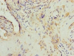 AP1M1 Polyclonal Antibody:Antibodies, Polyclonal