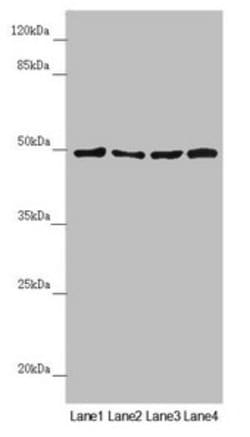 AP1M1 Polyclonal Antibody:Antibodies, Polyclonal