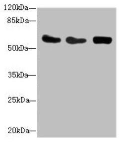 Invitrogen TAIP12 Polyclonal Antibody 100 &mu;L; Unconjugated:Antibodies,