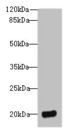 DEFB129 Polyclonal Antibody:Antibodies, Polyclonal