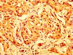 Invitrogen ABCG5 Polyclonal Antibody 100 &mu;g; Unconjugated:Antibodies,