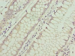 Invitrogen ASB7 Polyclonal Antibody 100 &mu;g; Unconjugated:Antibodies,
