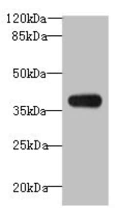 Invitrogen ASB7 Polyclonal Antibody 100 &mu;g; Unconjugated:Antibodies,