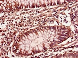 Invitrogen NARFL Polyclonal Antibody 100 &mu;g; Unconjugated:Antibodies,
