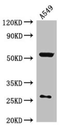 Invitrogen NARFL Polyclonal Antibody 100 &mu;g; Unconjugated:Antibodies,