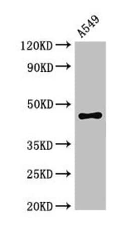 Invitrogen PHAX Polyclonal Antibody 100 &mu;g | Buy Online | Invitrogen&trade; | Fisher Scientific