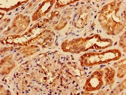 Invitrogen AGPAT3 Polyclonal Antibody 100 &mu;g; Unconjugated:Antibodies,