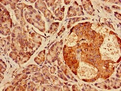 Invitrogen AGPAT3 Polyclonal Antibody 100 &mu;g; Unconjugated:Antibodies,