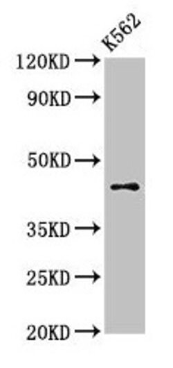 Invitrogen AGPAT3 Polyclonal Antibody 100 &mu;g; Unconjugated:Antibodies,