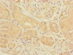 eIF3k Polyclonal Antibody:Antibodies, Polyclonal