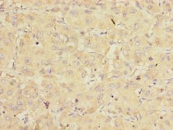 eIF3k Polyclonal Antibody:Antibodies, Polyclonal