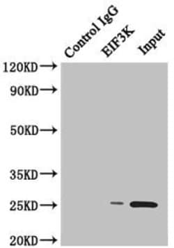 eIF3k Polyclonal Antibody:Antibodies, Polyclonal