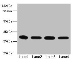 eIF3k Polyclonal Antibody:Antibodies, Polyclonal