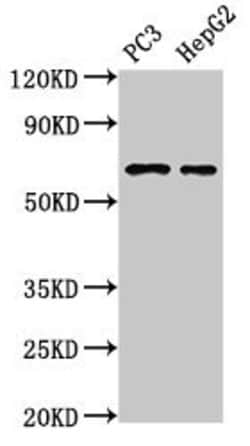 PARP2 Polyclonal Antibody:Antibodies, Polyclonal
