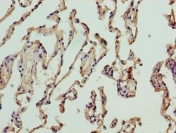 Invitrogen NICN1 Polyclonal Antibody 100 &mu;g; Unconjugated:Antibodies,
