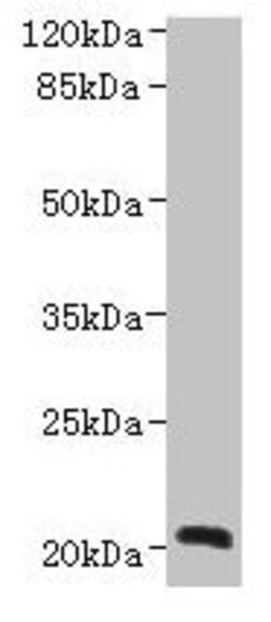 Invitrogen NICN1 Polyclonal Antibody 100 &mu;g; Unconjugated:Antibodies,