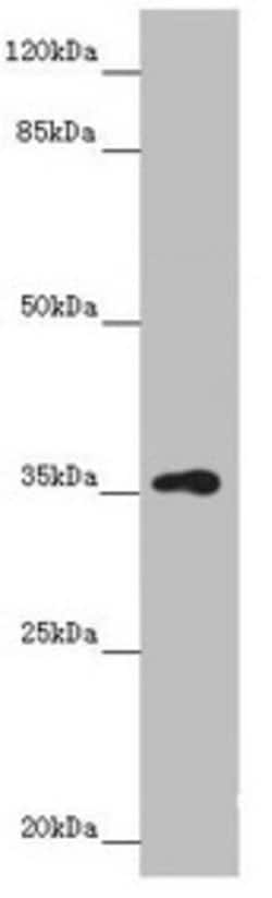 Invitrogen GNB1L Polyclonal Antibody 100 &mu;L; Unconjugated:Antibodies,