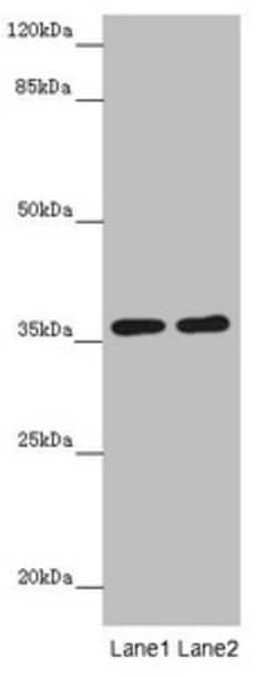 Invitrogen GNB1L Polyclonal Antibody 100 &mu;L; Unconjugated:Antibodies,