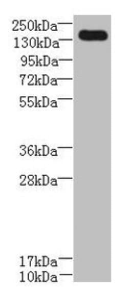 UBE2O Polyclonal Antibody:Antibodies, Polyclonal