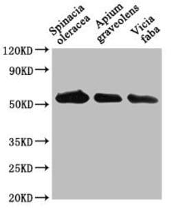 Invitrogen PEX14 Polyclonal Antibody 100 &mu;L | Buy Online | Invitrogen&trade; | Fisher Scientific
