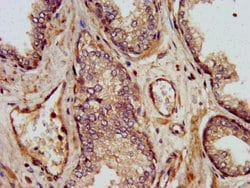 Invitrogen SHARPIN Polyclonal Antibody 100 &mu;g; Unconjugated:Antibodies,
