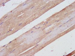Invitrogen SHARPIN Polyclonal Antibody 100 &mu;g; Unconjugated:Antibodies,