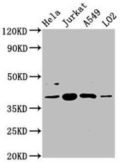 Invitrogen SHARPIN Polyclonal Antibody 100 &mu;g; Unconjugated:Antibodies,