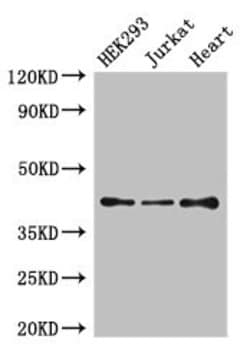 Invitrogen EDG8 Polyclonal Antibody 100 &mu;g | Buy Online | Invitrogen&trade; | Fisher Scientific