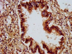 Invitrogen ALG9 Polyclonal Antibody 100 &mu;g; Unconjugated:Antibodies,