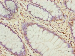 Invitrogen C6orf211 Polyclonal Antibody 100 &mu;g; Unconjugated:Antibodies,